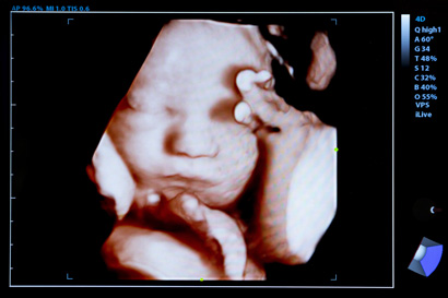 Dítě v děloze dotýkající se svého obličeje