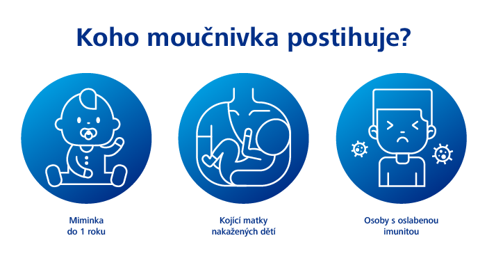 Moučnivka nejčastěji postihuje miminka, kojící matky a jedince s oslabenou imunitou Moučnivka nejčastěji postihuje miminka, kojící matky a jedince s oslabenou imunitou