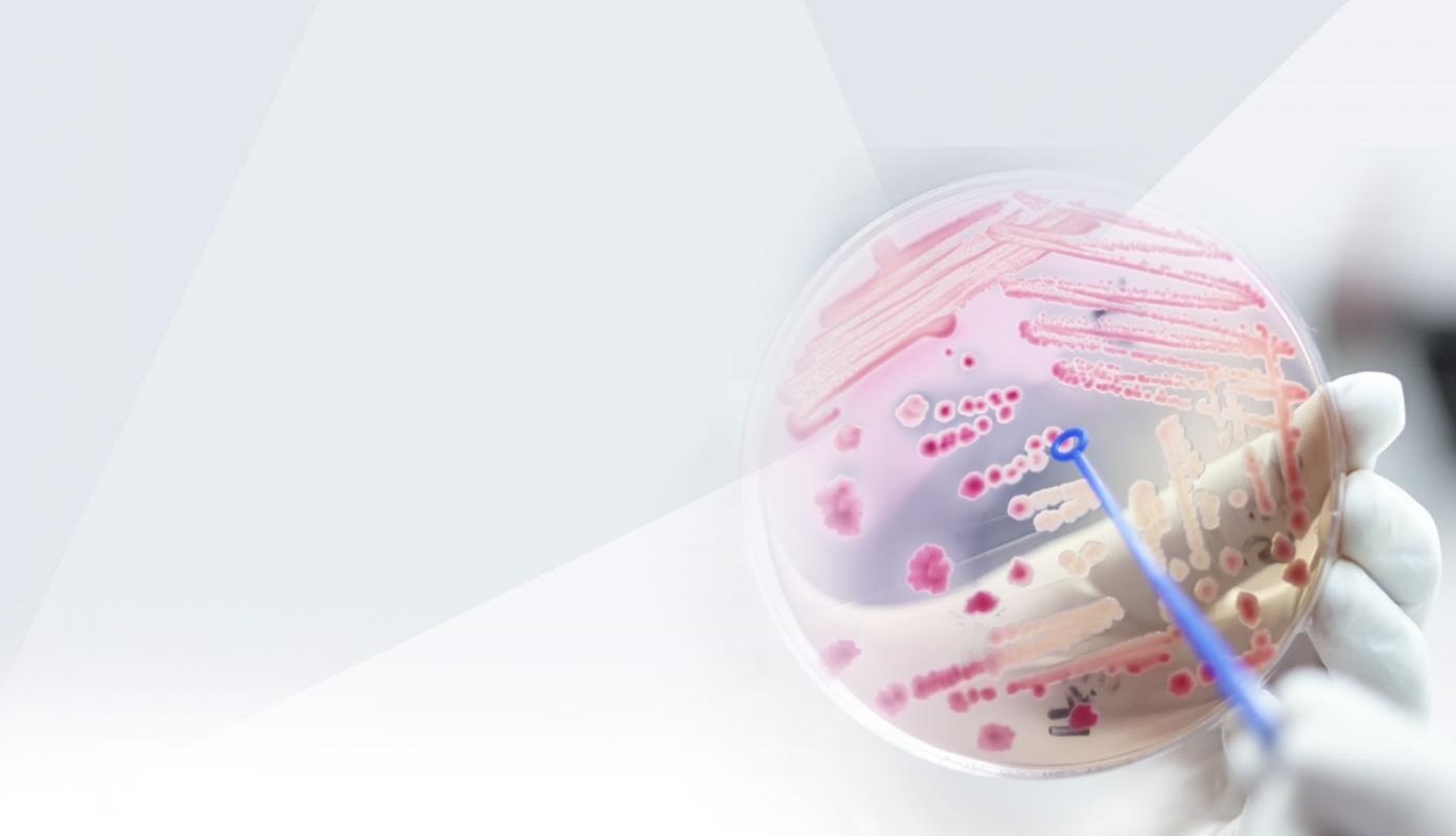 Kolonie bakterií na Petriho misce
